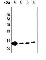 1 - Anti-CLIC4 Antibody [KO/KD Validated] AP60098