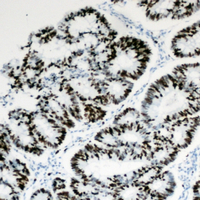 19 - Anti-HBP1 Antibody AP60099