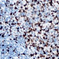 19 - Anti-ANKRD1 Antibody AP60100