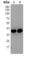 1 - Anti-ANKRD1 Antibody AP60100