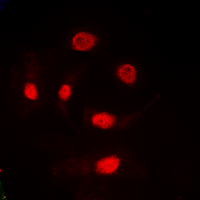 3 - Anti-TRA2A Antibody AP60101