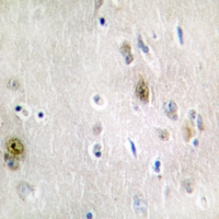 19 - Anti-TRA2A Antibody AP60101