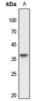 1 - Anti-TRA2A Antibody AP60101