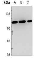 1 - Anti-PNPLA8 Antibody AP60102