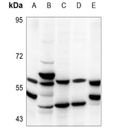 1 - Anti-TBX22 Antibody AP60103