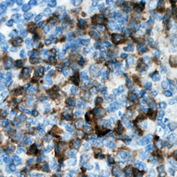 19 - Anti-CDKL3 Antibody AP60104
