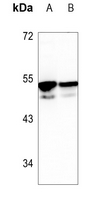 1 - Anti-CDKL3 Antibody AP60104