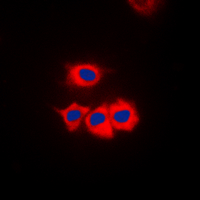 3 - Anti-CK1 gamma 1 Antibody AP60105