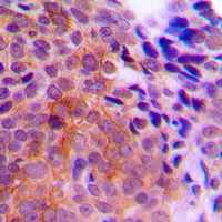 19 - Anti-CK1 gamma 1 Antibody AP60105