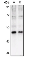 1 - Anti-CK1 gamma 1 Antibody AP60105