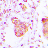 19 - Anti-MOV10L1 Antibody AP60107