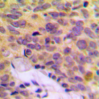19 - Anti-MRPL16 Antibody AP60108
