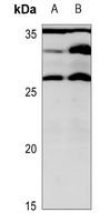 1 - Anti-MRPL16 Antibody AP60108