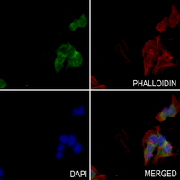 3 - Anti-BAIAP2L1 Antibody AP60109