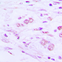 19 - Anti-BAIAP2L1 Antibody AP60109