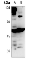 1 - Anti-BAIAP2L1 Antibody AP60109