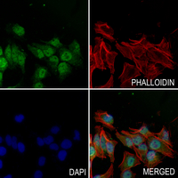 3 - Anti-SH3GLB2 Antibody AP60110