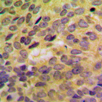 19 - Anti-SH3GLB2 Antibody AP60110