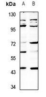 1 - Anti-SH3GLB2 Antibody AP60110