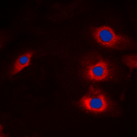 3 - Anti-HECW2 Antibody AP60112