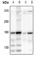 1 - Anti-HECW2 Antibody AP60112