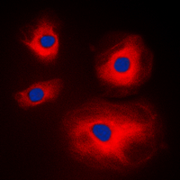 3 - Anti-MRPL11 Antibody AP60114