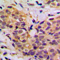 19 - Anti-MRPL11 Antibody AP60114