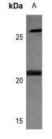 1 - Anti-MRPL11 Antibody AP60114