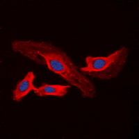 3 - Anti-CHSY2 Antibody AP60115
