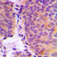 19 - Anti-CHSY2 Antibody AP60115