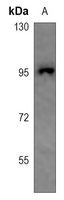 1 - Anti-CHSY2 Antibody AP60115