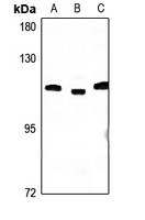 1 - Anti-CCP2 Antibody AP60116