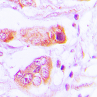 19 - Anti-BAIAP2L2 Antibody AP60117