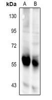 1 - Anti-BAIAP2L2 Antibody AP60117