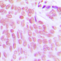 19 - Anti-ITPKC Antibody AP60118