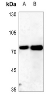 1 - Anti-ITPKC Antibody AP60118