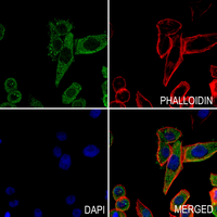 3 - Anti-CEP70 Antibody AP60119
