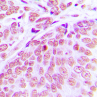19 - Anti-CEP70 Antibody AP60119