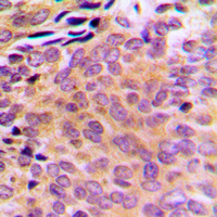 19 - Anti-AKR1CL2 Antibody AP60120