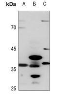 1 - Anti-AKR1CL2 Antibody AP60120