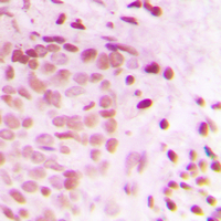19 - Anti-ATRIP Antibody AP60121