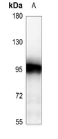 1 - Anti-ATRIP Antibody AP60121