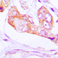 19 - Anti-PNPT1 Antibody AP60123
