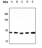 1 - Anti-PNPT1 Antibody AP60123