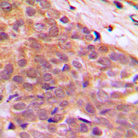 19 - Anti-CABLES1 Antibody AP60124