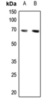 1 - Anti-CABLES1 Antibody AP60124