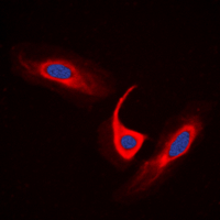 3 - Anti-ACOT4 Antibody AP60125