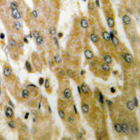 19 - Anti-ACOT4 Antibody AP60125