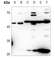 1 - Anti-ACOT4 Antibody AP60125