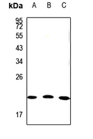 1 - Anti-Claudin 19 Antibody AP60126